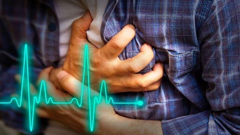 Cardiac Arrest - Heart Attack