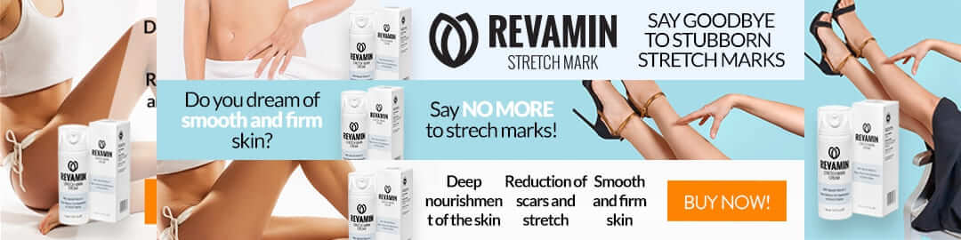 Fight Stretch Marks with Revamin Stretch Mark 11 2025 Fight Stretch Marks with Revamin Stretch Mark-Health Impress
