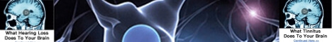 Tinnitus Types Causes Symptoms Treatment Effects 2025